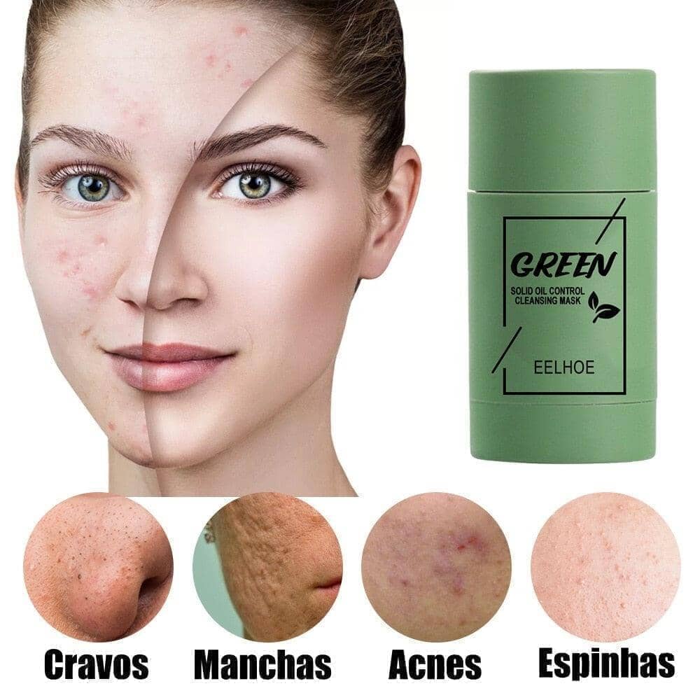 Mascara Removedora de Cravos, Acne e Poros - GreenMask® (ULTIMAS UNIDADES EM PROMOÇÃO)